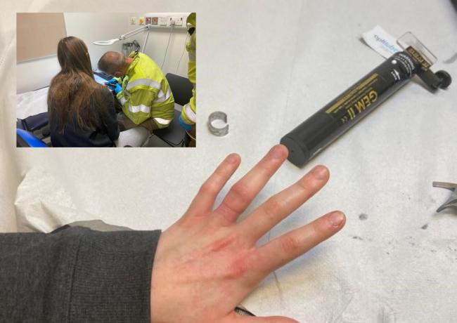 Firefighters race to A&E to remove ring stuck on woman's finger