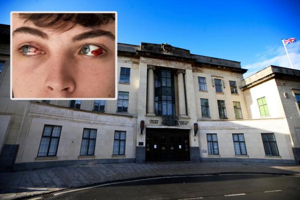 Oxford Crown Court and inset the injuries to Connor Fagan's eyes