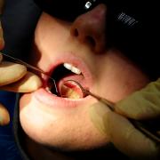 In England, 4.4 million children didn’t see an NHS dentist in the year to June 2023